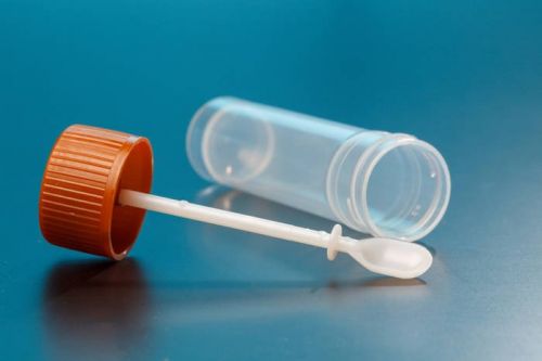 Обязательно следите за цветом своего кала, чтобы не пропустить заболевание