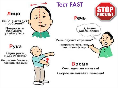FAST-тест