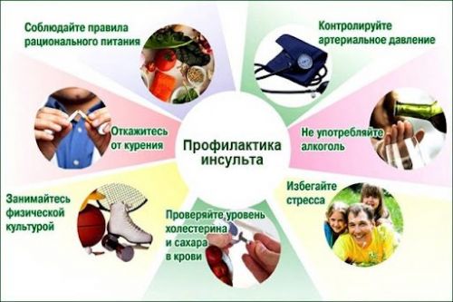 Профилактика инсульта