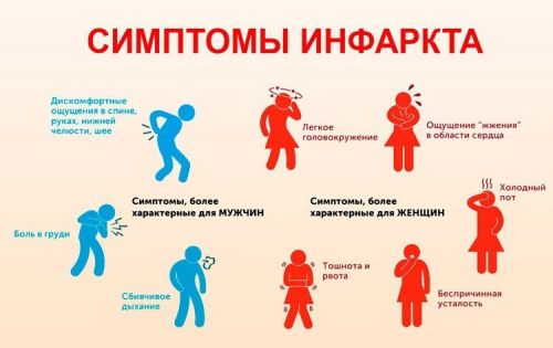 Симптомы инфаркта миокарда