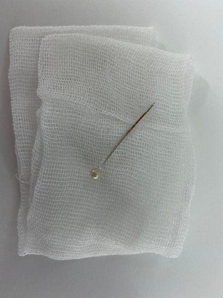 Игла, которую проглотил ребенок